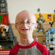 Image for article titled 10 Unusual Genetic Mutations in Humans